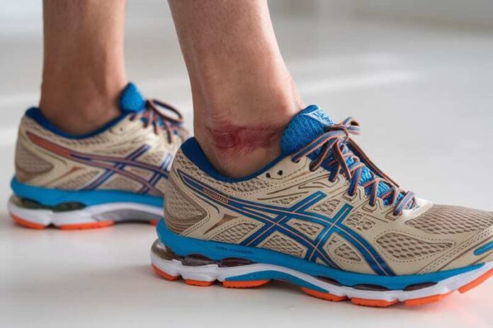 Running-Shoes-Rubbing-Side-Ankle-Bone-Quick-Fixes Running_Shoes_Rubbing_Side_Ankle_Bone_Quick_Fixes